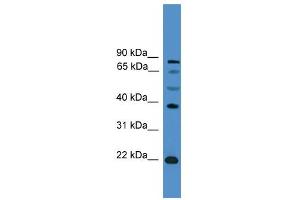 WB Suggested Anti-ASCL2 Antibody Titration:  0. (ASCL2 anticorps  (C-Term))