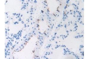 Detection of vWF in Rat Lung Tissue using Polyclonal Antibody to Von Willebrand Factor (vWF)