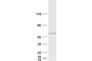 Validation with Western Blot