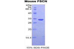 SDS-PAGE (SDS) image for Fascin (FSCN1) (AA 27-273) protein (His tag) (ABIN1877658) (Fascin Protein (FSCN1) (AA 27-273) (His tag))