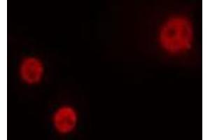 ABIN6274264 staining HeLa cells by IF/ICC. (HOXA1 anticorps  (Internal Region))