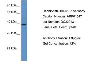 Western Blotting (WB) image for anti-RAD51 Homolog D (RAD51D) (C-Term) antibody (ABIN2788836) (RAD51D anticorps  (C-Term))