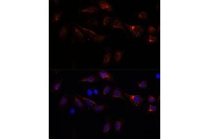 Immunofluorescence analysis of U-2 OS cells using PFDN4 antibody (ABIN7269508) at dilution of 1:100.