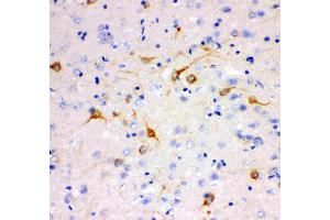 Anti- IP3 receptor antibody, IHC(P): Rat Brain Tissue (ITPR1 anticorps  (AA 2411-2758))