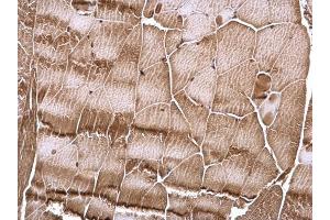 IHC-P Image RSK2 antibody detects RSK2 protein at cytosol and nucleus on mouse muscle by immunohistochemical analysis.