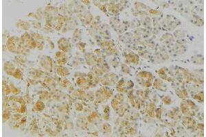 ABIN6276762 at 1/100 staining Human gastric tissue by IHC-P. (HLA-DRB3 anticorps)