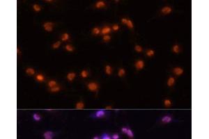 Immunofluorescence analysis of U-251MG cells using PRPF8 Polyclonal Antibody at dilution of 1:100 (20x lens). (PRPF8 anticorps)