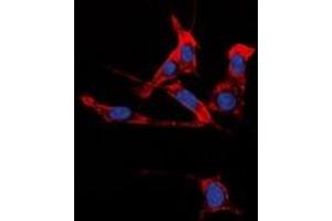 Immunofluorescent analysis of EPHB1/2 staining in HuvEc cells. (EPHB1/2 anticorps)