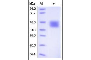 Human CD84, His Tag on SDS-PAGE under reducing (R) condition. (CD84 Protein (CD84) (AA 22-225) (His tag))