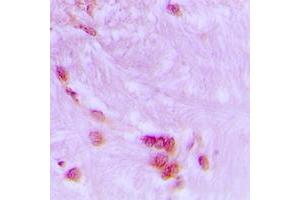 Immunohistochemical analysis of CDC27 staining in human brain formalin fixed paraffin embedded tissue section.
