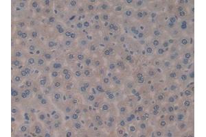 Detection of FIL1d in Mouse Liver Tissue using Polyclonal Antibody to Interleukin 1 Delta (FIL1d)