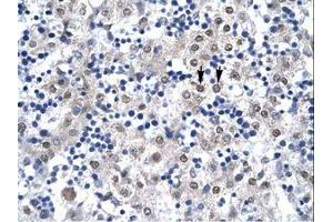 Image no. 2 for anti-Caudal Type Homeobox 4 (CDX4) (C-Term) antibody (ABIN6736267)