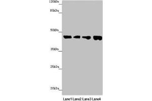 Western blot All lanes: FBXO22 antibody at 1. (FBXO22 anticorps  (AA 104-403))