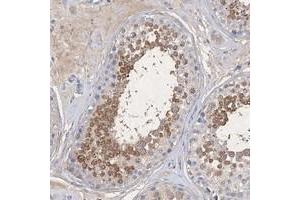 Immunohistochemical staining of human testis with C11orf58 polyclonal antibody  shows moderate cytoplasmic positivity in cells in seminiferus ducts at 1:20-1:50 dilution. (C11ORF58 anticorps)