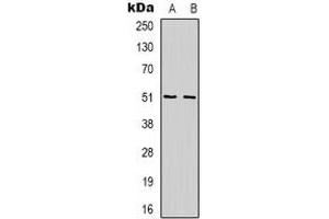 Western blot analysis of WIPF1 expression in Jurkat (A), K562 (B) whole cell lysates. (WIPF1 anticorps  (C-Term))