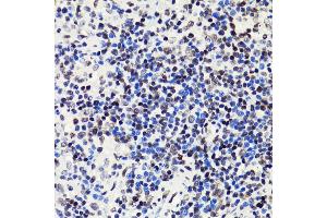 Immunohistochemistry of paraffin-embedded rat spleen using Acetyl-Histone H2B-K5 antibody (ABIN7267733) at dilution of 1:100 (40x lens).