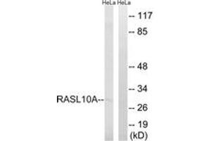 Western blot analysis of extracts from HeLa cells, using RASL10A Antibody. (RASL10A anticorps  (AA 107-156))