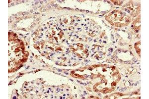 Immunohistochemistry of paraffin-embedded human kidney tissue using ABIN7170330 at dilution of 1:100 (SORD anticorps  (AA 201-357))