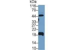 Detection of UPK2 in Human Urine using Polyclonal Antibody to Uroplakin 2 (UPK2) (Uroplakin 2 anticorps  (AA 26-153))