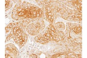 IHC-P Image Immunohistochemical analysis of paraffin-embedded Cal27 xenograft, using Galactosidase alpha, antibody at 1:100 dilution.