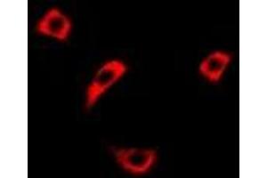 Immunofluorescent analysis of RASSF1 staining in Hela cells. (RASSF1 anticorps)