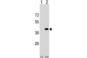 Western Blotting (WB) image for anti-Protein Phosphatase 1, Catalytic Subunit, gamma Isoform (PPP1CC) antibody (ABIN2999122)