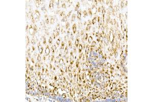 Immunohistochemistry of paraffin-embedded human esophagus using MDH2 Rabbit mAb (ABIN7268381) at dilution of 1:25 (40x lens). (MDH2 anticorps)