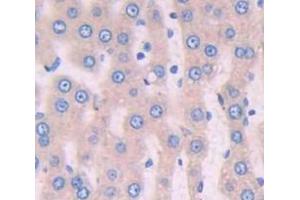 IHC-P analysis of Rat Tissue, with DAB staining. (Periostin anticorps  (AA 24-173))