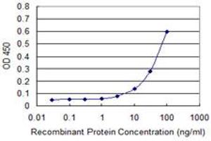 anti-Fragile Histidine Triad (FHIT) (AA 31-130) antibody