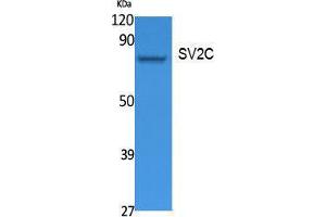 Western Blotting (WB) image for anti-Synaptic Vesicle Glycoprotein 2C (SV2C) (Internal Region) antibody (ABIN3187638) (SV2C anticorps  (Internal Region))