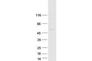 Validation with Western Blot
