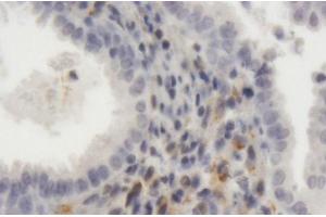 Immunoperoxidase of purified MaxPab antibody to LRP1 on formalin-fixed paraffin-embedded human endometrium. (LRP1 anticorps  (AA 1-292))