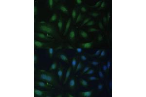 anti-Cyclin-Dependent Kinase Inhibitor 1B (p27, Kip1) (CDKN1B) (AA 1-198) antibody