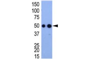Western Blotting (WB) image for anti-HA-Tag antibody (ABIN2932102) (HA-Tag anticorps)