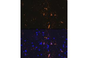 Immunofluorescence analysis of rat brain using GFAP Rabbit mAb (ABIN7267389) at dilution of 1:100 (40x lens).