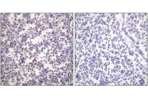 Immunohistochemistry analysis of paraffin-embedded human lymph node, using B-RAF (Phospho-Ser602) Antibody.