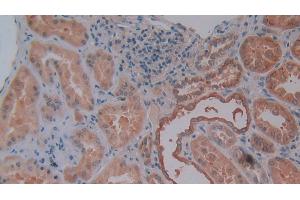 Detection of OPN in Human Kidney Tissue using Polyclonal Antibody to Osteopontin (OPN)