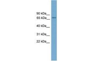 Image no. 1 for anti-Protein Kinase C, eta (PRKCH) (AA 35-84) antibody (ABIN6746461) (PKC eta anticorps  (AA 35-84))