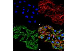 Immunocytochemistry/Immunofluorescence analysis using Rabbit Anti-WDFY3 Polyclonal Antibody . (WDFY3 anticorps  (AA 533-544) (FITC))