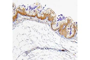 IHC analysis of ALDH1A1 using anti-ALDH1A1 antibody (ABIN7602127). (ALDH1A1 anticorps  (AA 6-342))