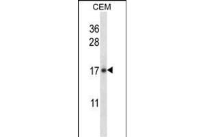 IL21 Antibody (C-term) (ABIN657761 and ABIN2846740) western blot analysis in CEM cell line lysates (35 μg/lane). (IL-21 anticorps  (C-Term))
