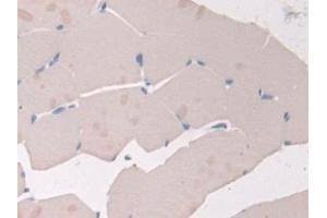 Detection of ADIPOR2 in Rat Skeletal muscle Tissue using Polyclonal Antibody to Adiponectin Receptor 2 (ADIPOR2)