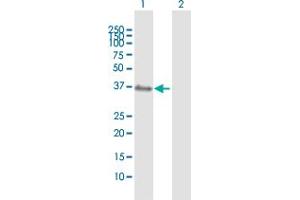 Western Blot analysis of XPA expression in transfected 293T cell line by XPA MaxPab polyclonal antibody.