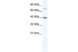 WB Suggested Anti-GLI4 Antibody Titration:  1. (GLI4 anticorps  (N-Term))