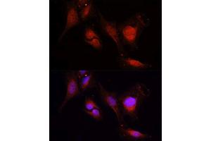 Immunofluorescence analysis of U2OS cells using MMP2 antibody.