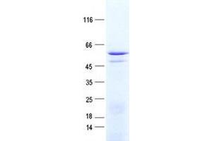Validation with Western Blot