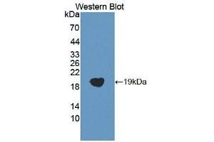 Detection of Recombinant COTL1, Human using Polyclonal Antibody to Coactosin Like Protein 1 (COTL1)