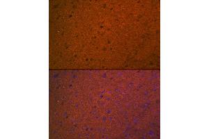 Immunofluorescence analysis of mouse brain using STX1A Rabbit mAb (ABIN7270684) at dilution of 1:100 (40x lens).