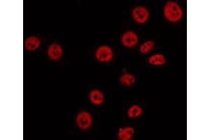 ABIN6274880 staining 293 by IF/ICC. (ABCA6 anticorps  (Internal Region))