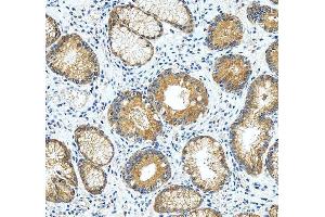 IHC analysis of RASAL1 using anti-RASAL1 antibody (ABIN6719367). (RASAL1 anticorps  (AA 721-798))